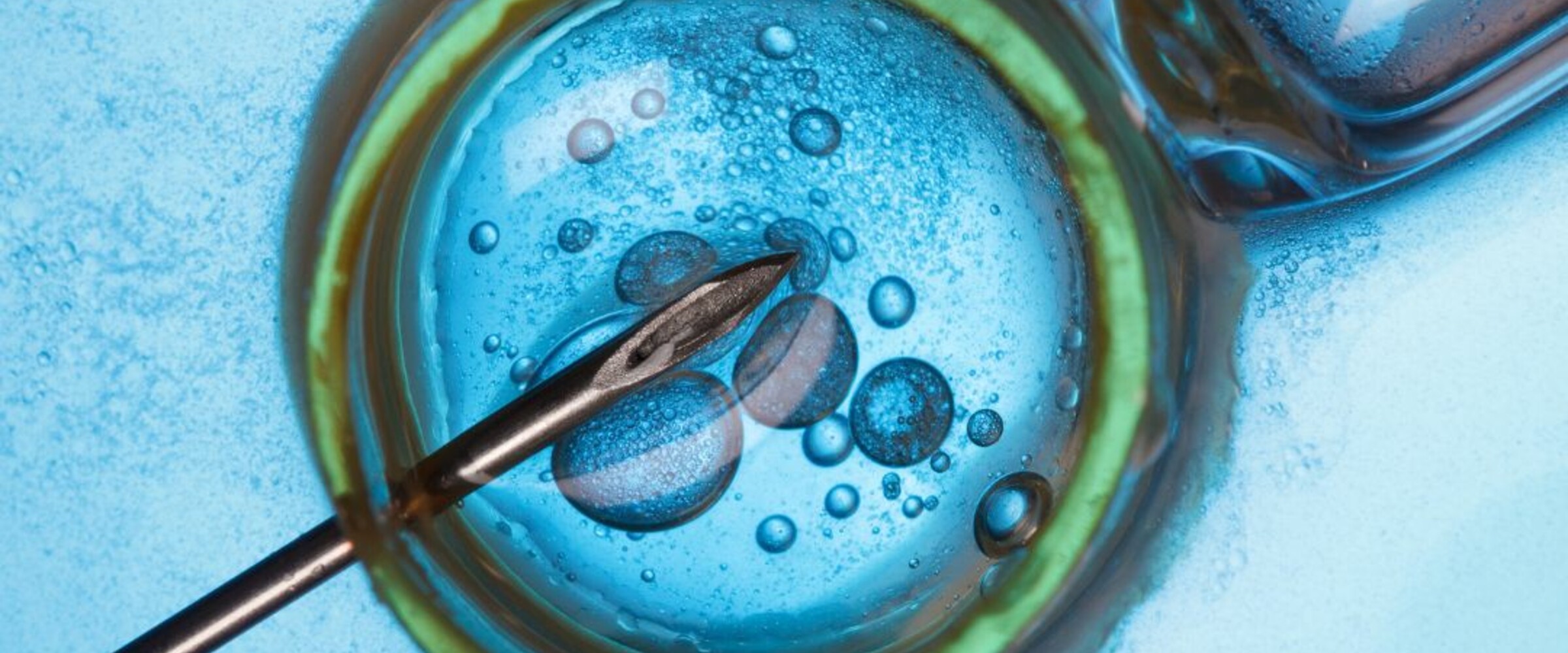 IVF
