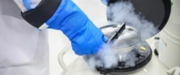 fertility preservation